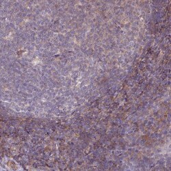 LRRC41 Antibody, Novus Biologicals 25 &mu;L, Unlabeled:Antibodies, Polyclonal